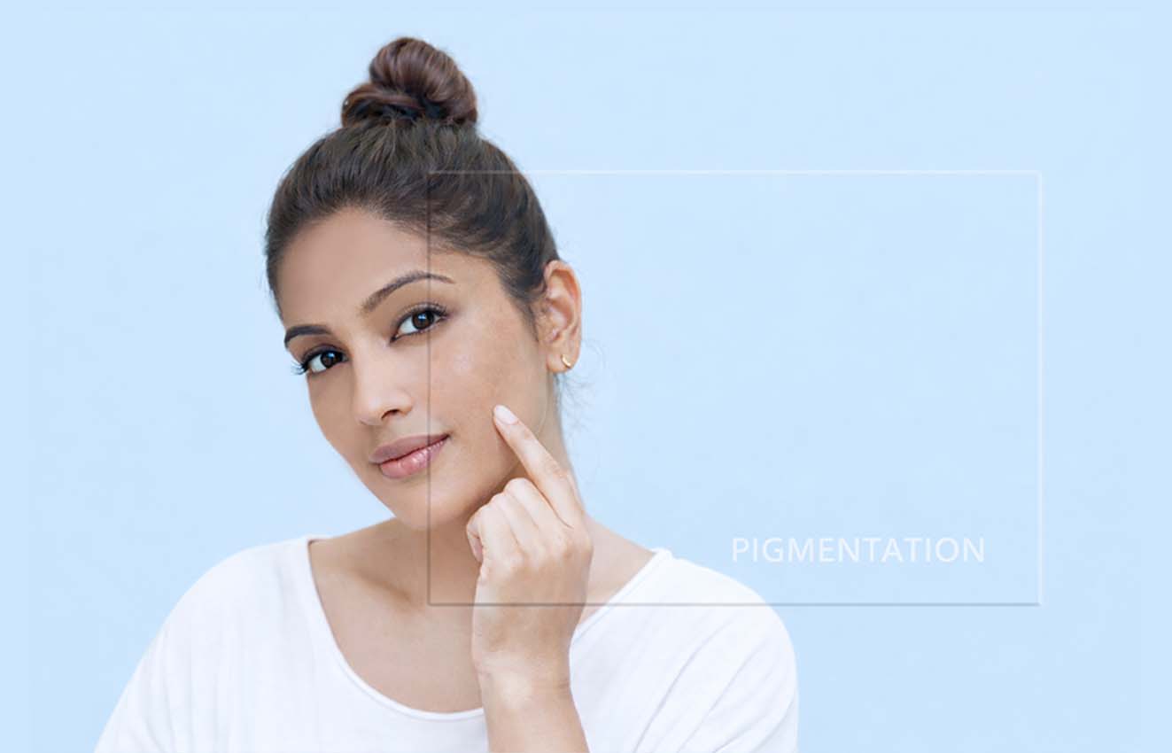Uncovering Pigmentation: What Really Happens to Your Skin
